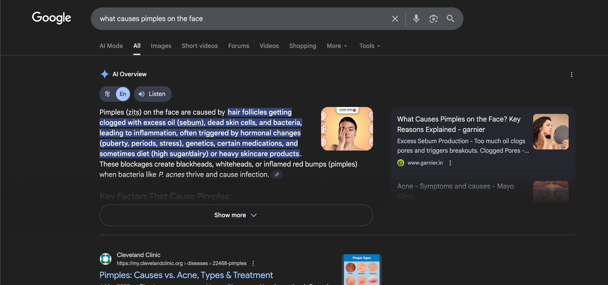 Cause-and-effect queries